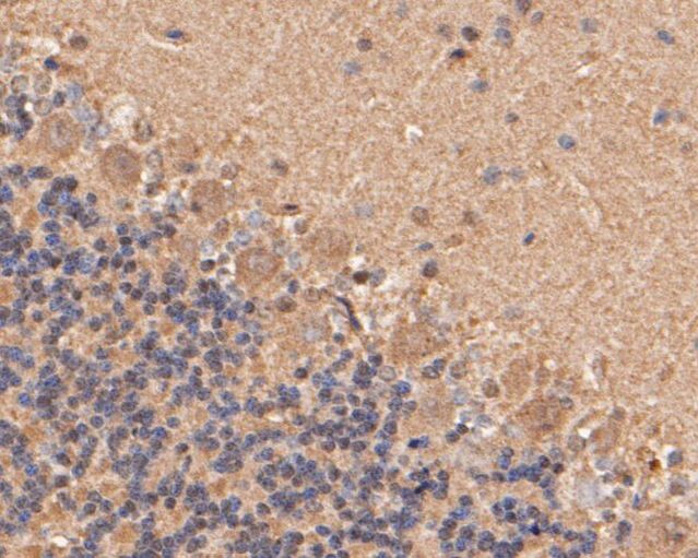 Cathepsin D Antibody in Immunohistochemistry (Paraffin) (IHC (P))