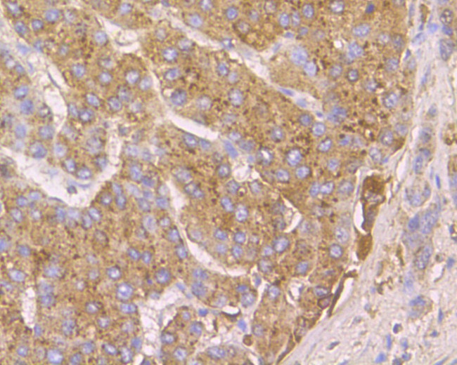 Cathepsin D Antibody in Immunohistochemistry (Paraffin) (IHC (P))