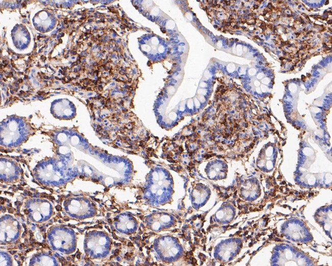 SPATA5L1 Antibody in Immunohistochemistry (Paraffin) (IHC (P))