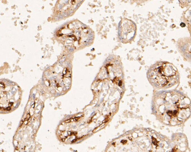 Factor XIII A Antibody in Immunohistochemistry (Paraffin) (IHC (P))