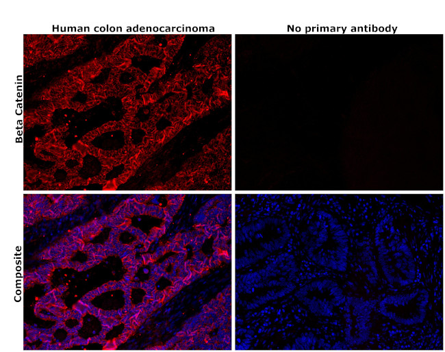 beta Catenin Antibody in Immunohistochemistry (Paraffin) (IHC (P))