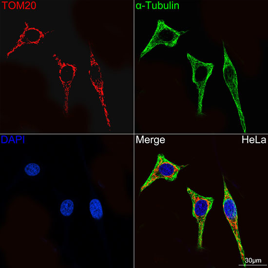 TOM20 Antibody in Immunocytochemistry (ICC/IF)