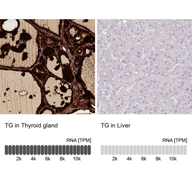 Thyroglobulin Antibody in Immunohistochemistry (Paraffin) (IHC (P))