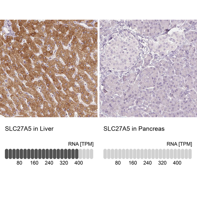 SLC27A5 Antibody in Immunohistochemistry (Paraffin) (IHC (P))