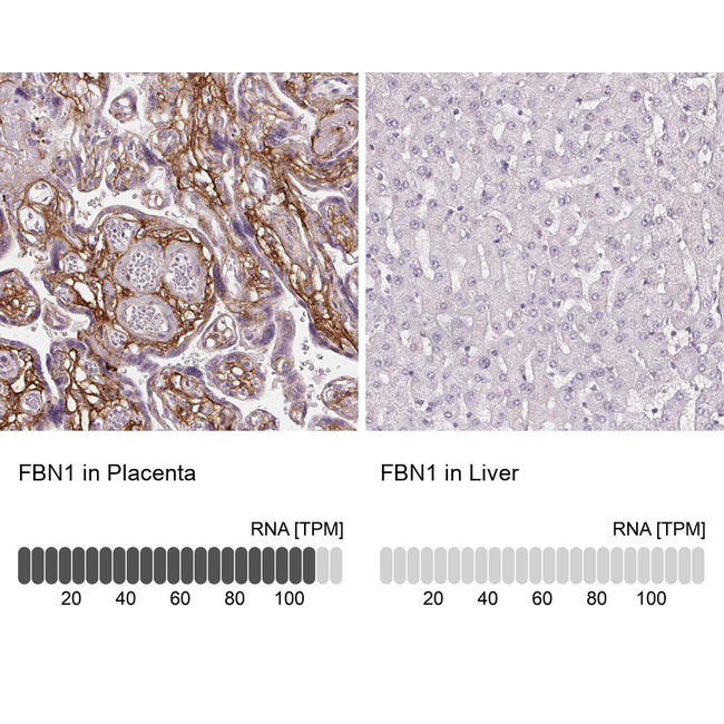 Fibrillin 1 Antibody in Immunohistochemistry (Paraffin) (IHC (P))