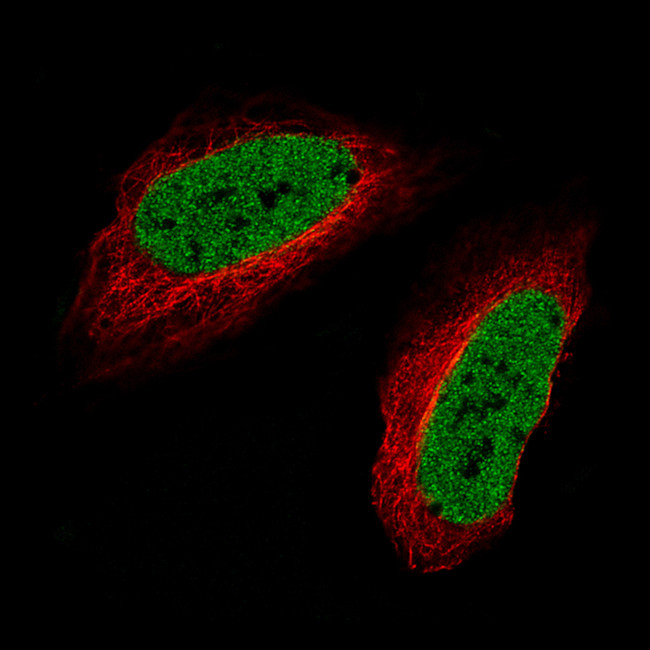 SATB2 Antibody in Immunocytochemistry (ICC/IF)