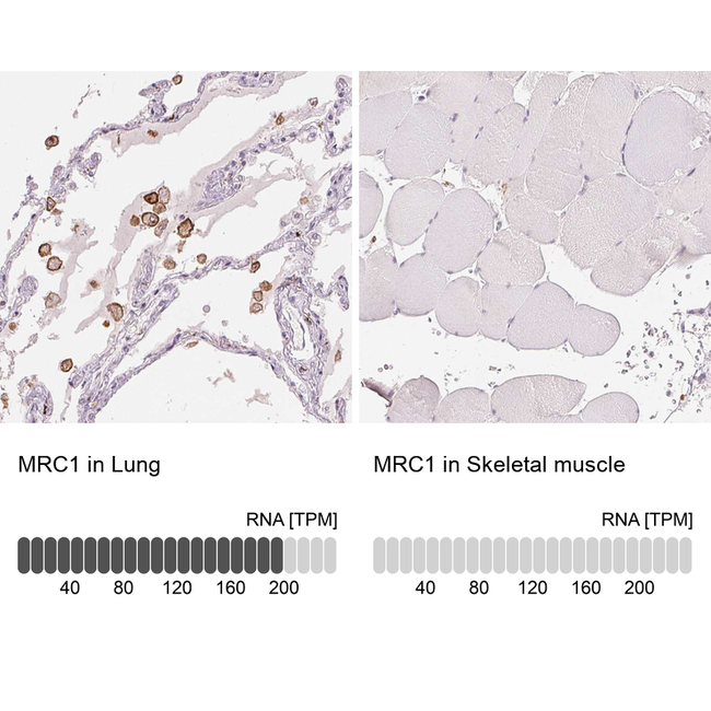 CD206 Antibody in Immunohistochemistry (Paraffin) (IHC (P))
