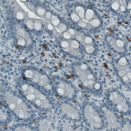 c-Kit Antibody in Immunohistochemistry (Paraffin) (IHC (P))