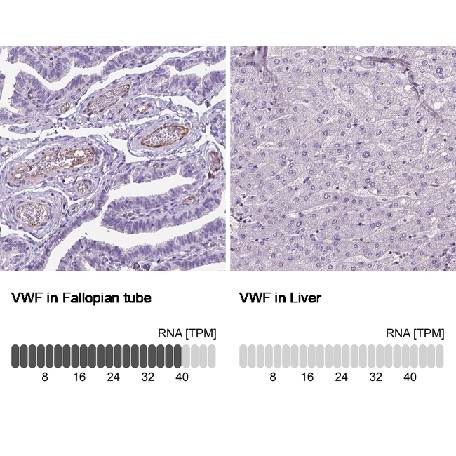 VWF Antibody in Immunohistochemistry (Paraffin) (IHC (P))