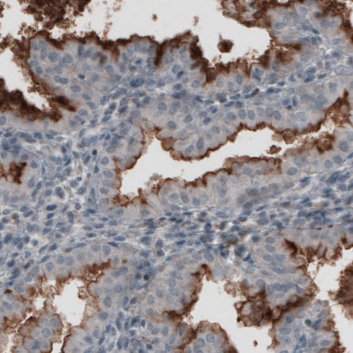 CA125 Antibody in Immunohistochemistry (Paraffin) (IHC (P))