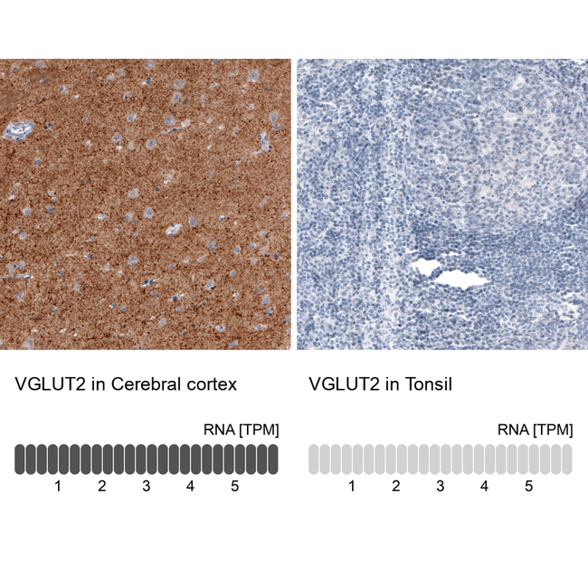 VGLUT2 Antibody in Immunohistochemistry (Paraffin) (IHC (P))