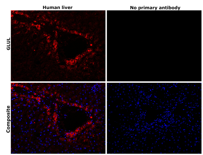 Glutamine Synthetase Antibody in Immunohistochemistry (Paraffin) (IHC (P))