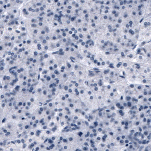OATP8 Antibody in Immunohistochemistry (Paraffin) (IHC (P))