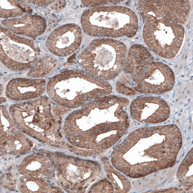 B-Raf Antibody in Immunohistochemistry (Paraffin) (IHC (P))