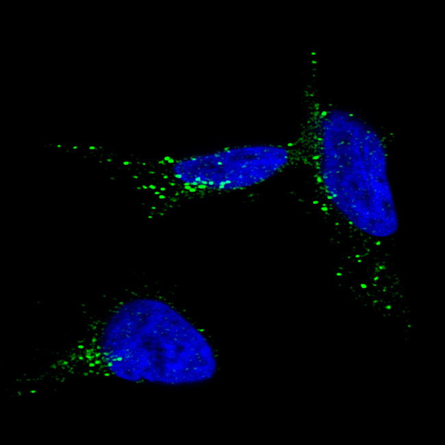 TYRP1 Antibody in Immunocytochemistry (ICC/IF)