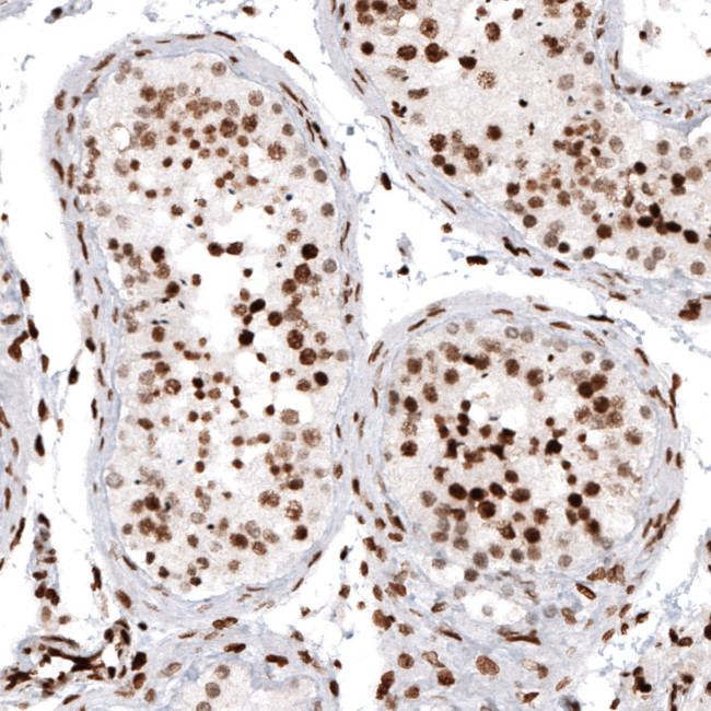HIST1H2AG Antibody in Immunohistochemistry (Paraffin) (IHC (P))