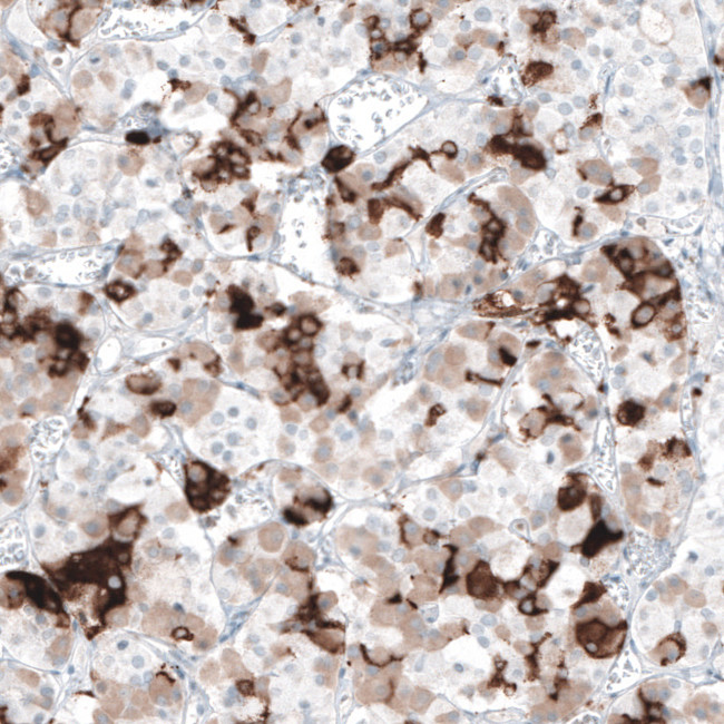 Prolactin Antibody in Immunohistochemistry (Paraffin) (IHC (P))