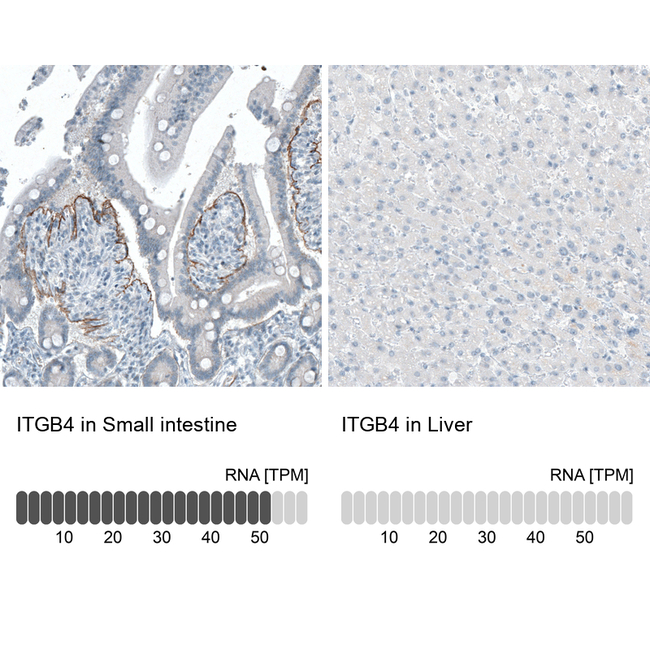 CD104 Antibody in Immunohistochemistry (Paraffin) (IHC (P))