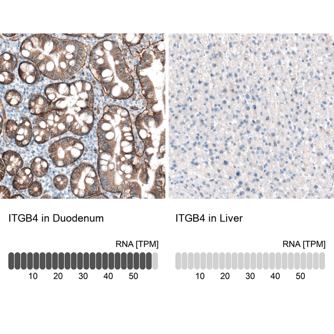 CD104 Antibody in Immunohistochemistry (Paraffin) (IHC (P))