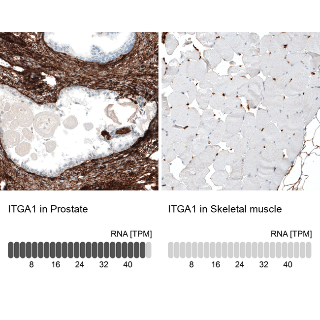 CD49a Antibody in Immunohistochemistry (Paraffin) (IHC (P))