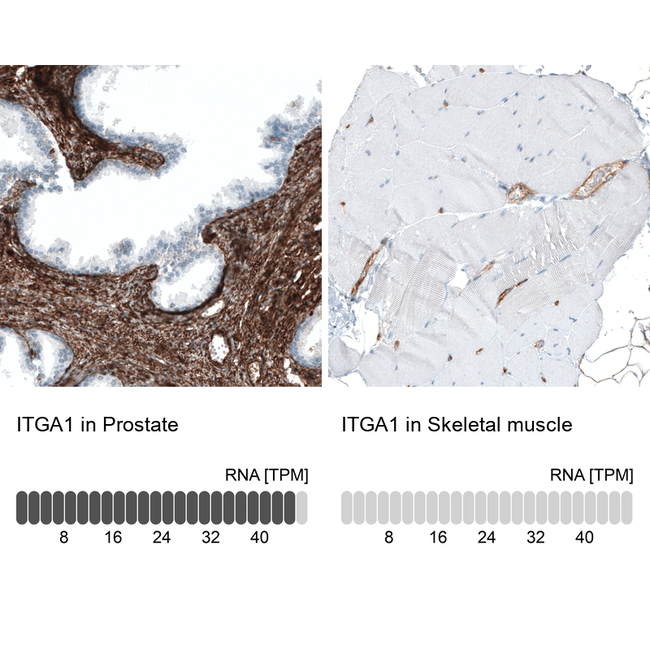 CD49a Antibody in Immunohistochemistry (Paraffin) (IHC (P))