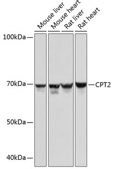 CPT2 Antibody in Western Blot (WB)