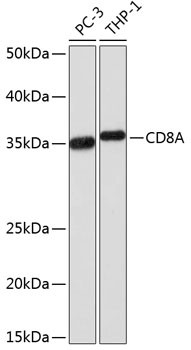 CD8a Antibody in Western Blot (WB)