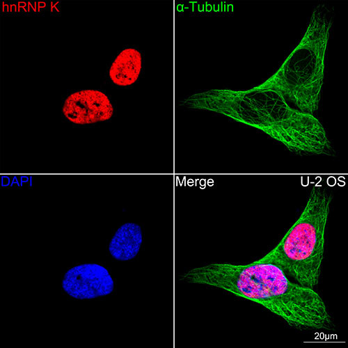 hnRNP K Antibody in Immunocytochemistry (ICC/IF)