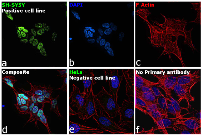 ISL1 Antibody in Immunocytochemistry (ICC/IF)