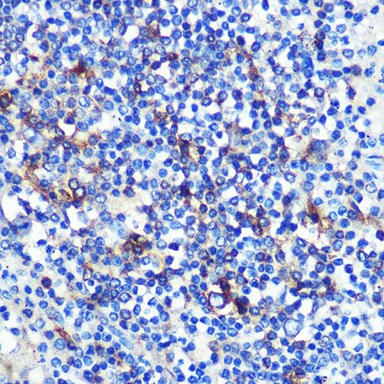 HLA-DRA Antibody in Immunohistochemistry (Paraffin) (IHC (P))