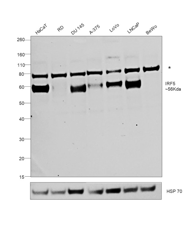 IRF5 Antibody in Western Blot (WB)
