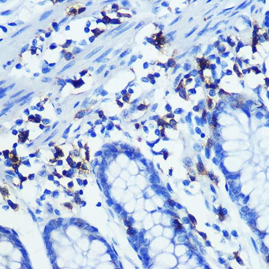 CD3z Antibody in Immunohistochemistry (Paraffin) (IHC (P))