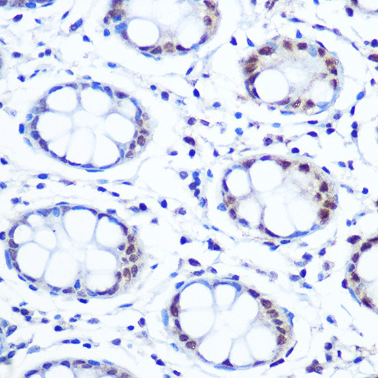 APE1 Antibody in Immunohistochemistry (Paraffin) (IHC (P))