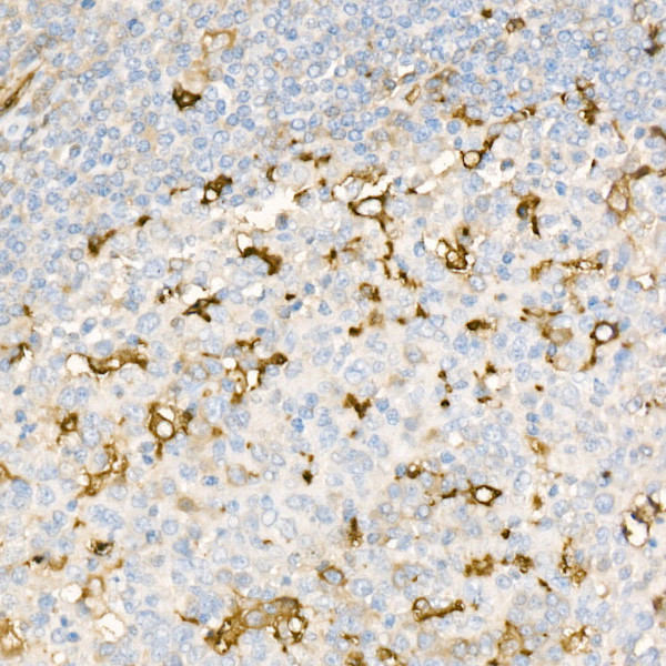 Ferritin Light Chain Antibody in Immunohistochemistry (Paraffin) (IHC (P))