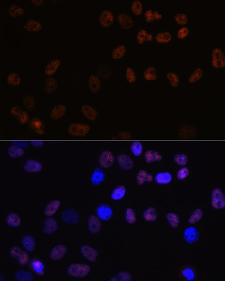 MCM7 Antibody in Immunocytochemistry (ICC/IF)