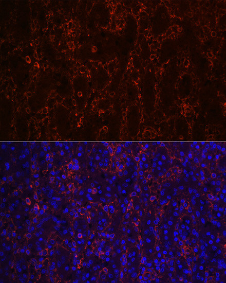 CD23 Antibody in Immunohistochemistry (Paraffin) (IHC (P))