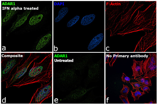 ADAR1 Antibody in Immunocytochemistry (ICC/IF)