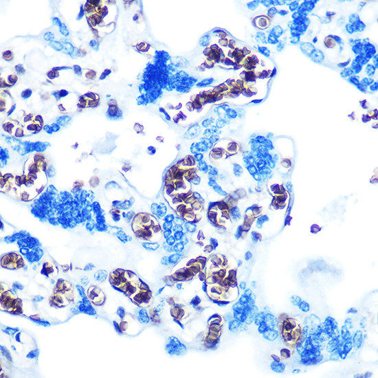 GYPC Antibody in Immunohistochemistry (Paraffin) (IHC (P))