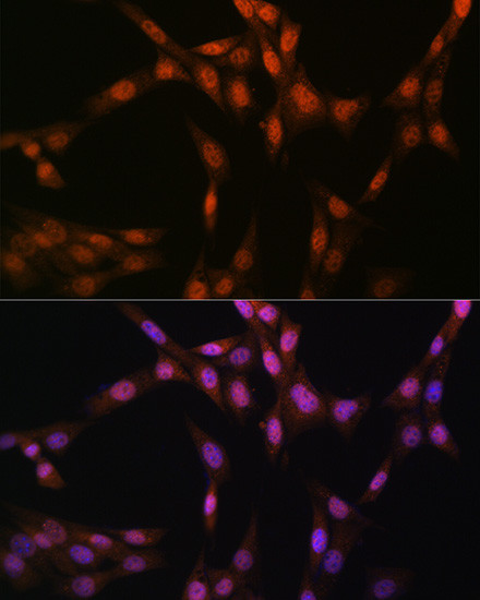 GSS Antibody in Immunocytochemistry (ICC/IF)