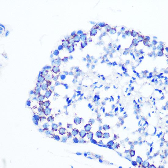 Monoamine Oxidase B Antibody in Immunohistochemistry (Paraffin) (IHC (P))