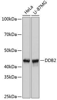 DDB2 Antibody in Western Blot (WB)