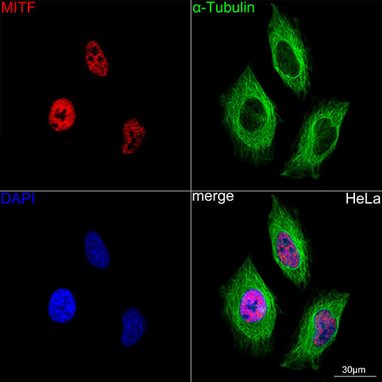 MiTF Antibody in Immunocytochemistry (ICC/IF)