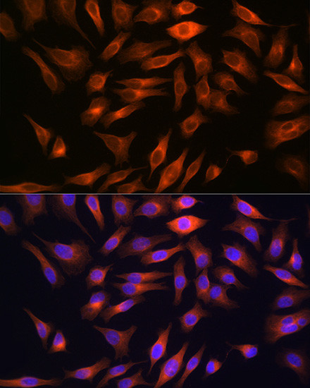 FBP1 Antibody in Immunocytochemistry (ICC/IF)
