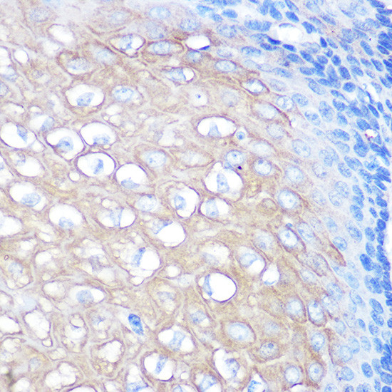 RHAMM Antibody in Immunohistochemistry (Paraffin) (IHC (P))