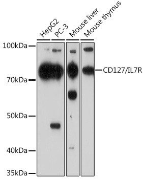 CD127 Antibody in Western Blot (WB)
