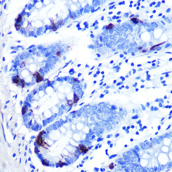AZGP1 Antibody in Immunohistochemistry (Paraffin) (IHC (P))