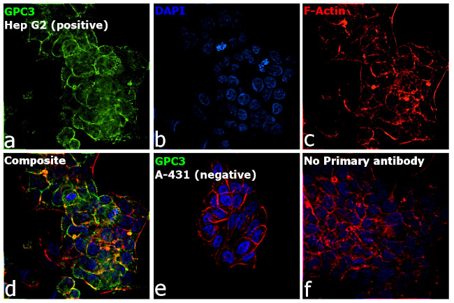Glypican 3 Antibody in Immunocytochemistry (ICC/IF)