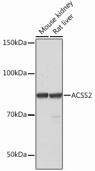 ACSS2 Antibody in Western Blot (WB)