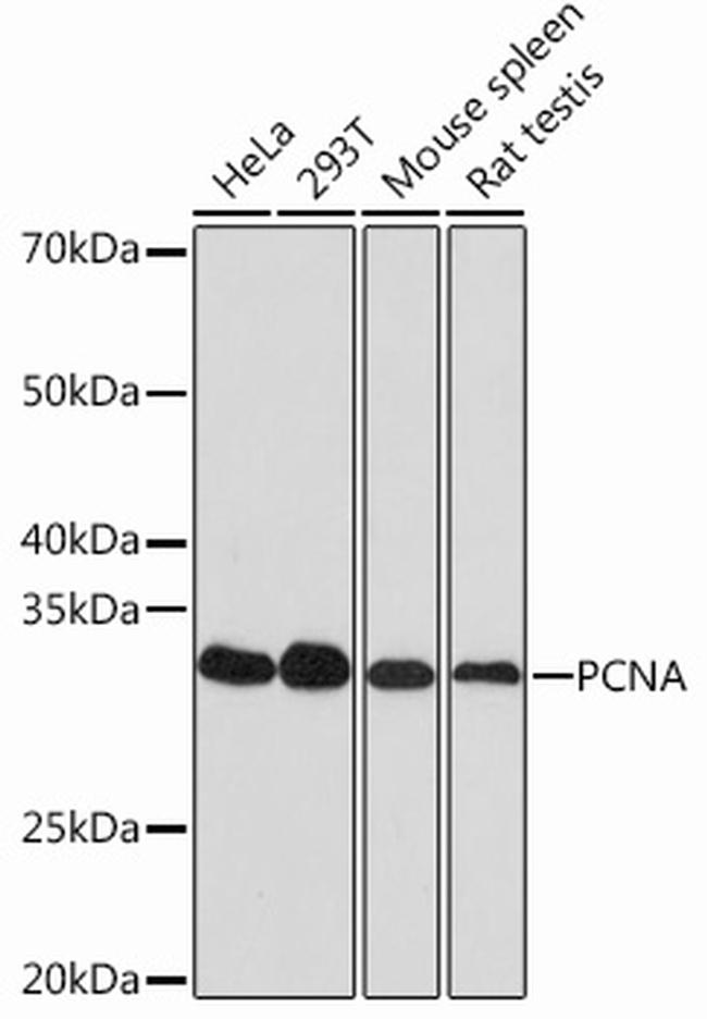 PCNA Monoclonal Antibody (10G4V5) (MA535171)