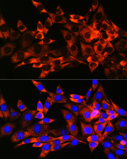 HSPB8 Antibody in Immunocytochemistry (ICC/IF)